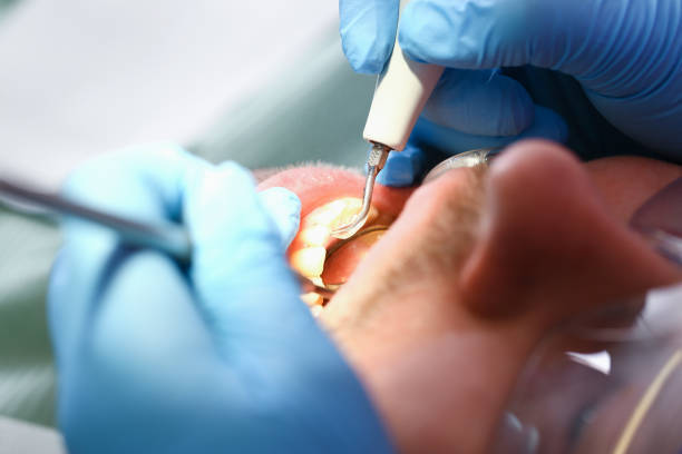 Best Emergency Denture Repair in Blacksburg, VA