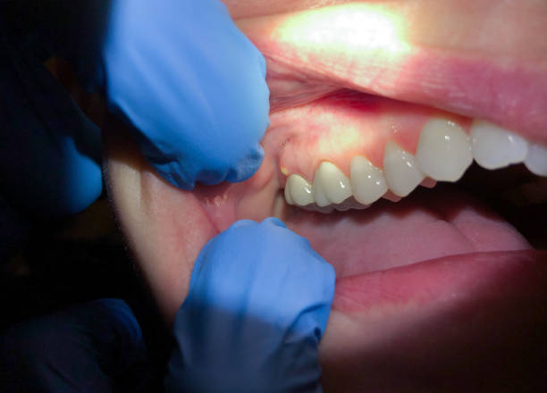 Best Cosmetic Emergency Dentistry in Blacksburg, VA