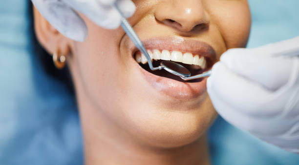 Best Cosmetic Emergency Dentistry in Blacksburg, VA